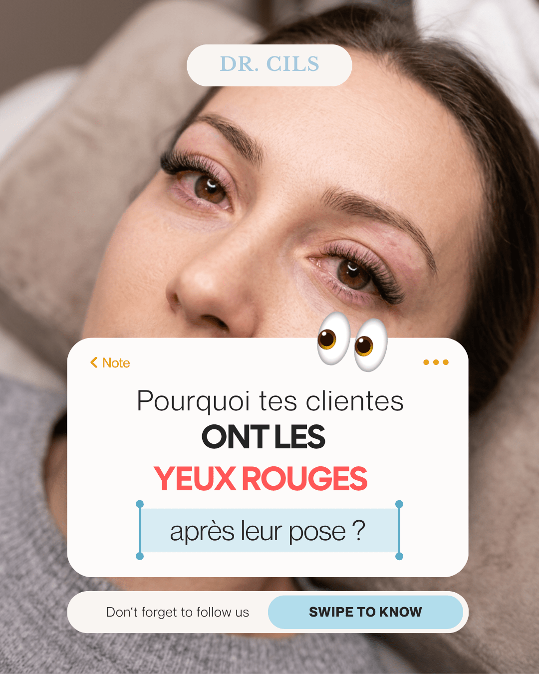 Pourquoi certaines clientes ont les yeux rouges après une pose d’extensions de cils ?